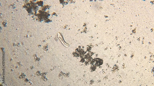 Microscopy of protozoa ciliate and small microorganisms in the water sample. Magnification 150x infusoria under microscope in active movement and feed process. photo