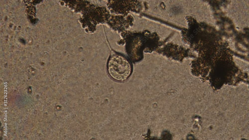 Microscopy of protozoa Vorticella in the water (pond) sample. Infusoria ...