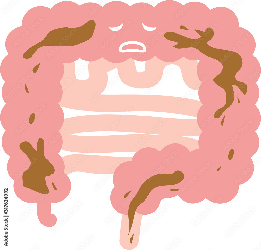 腸 下痢 のイラスト 内臓 消化器 Stock Vector Adobe Stock