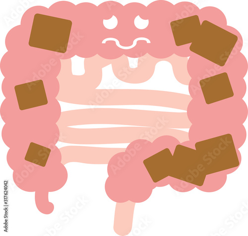腸（便秘）のイラスト　内臓　消化器