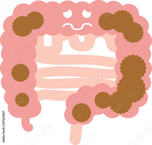 腸（便秘）のイラスト　内臓　消化器