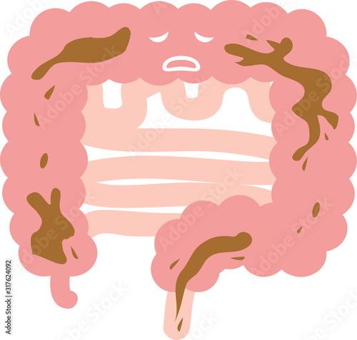 腸（下痢）のイラスト　内臓　消化器