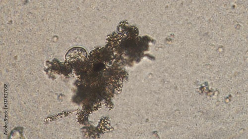 Microscopy of protozoa ciliate and small microorganisms in the water sample. Magnification 300x infusoria under microscope in active movement and feed process. photo