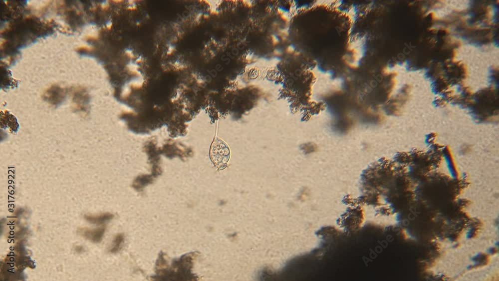 Microscopy of protozoa Vorticella in the water (pond) sample. Infusoria ...
