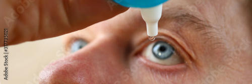 Male hand putting liquid drops in his eye