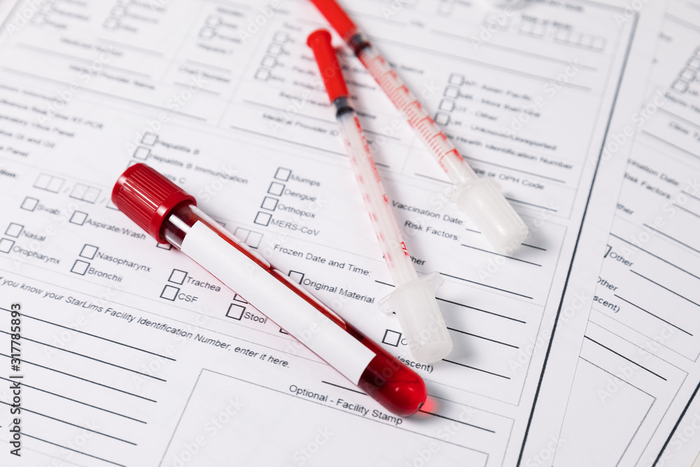 Test tubes with blood. nCov, Coronavirus test Test tubes with blood. nCov, Coronavirus test