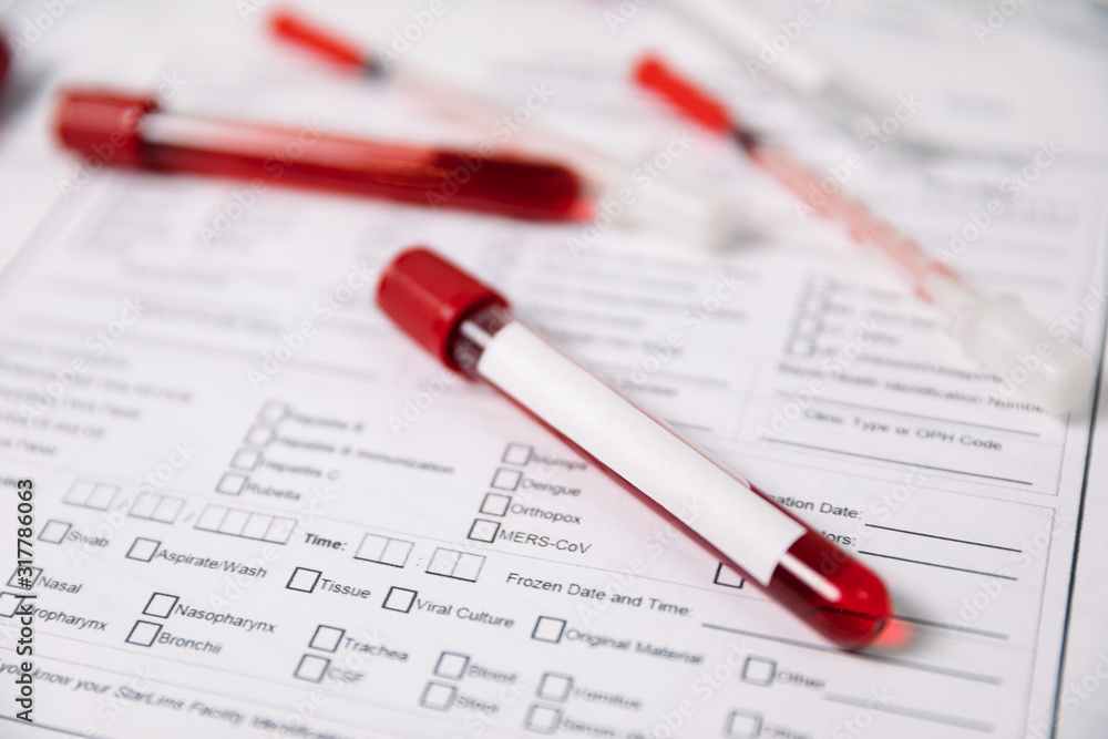 Test tubes with blood. nCov, Coronavirus test Test tubes with blood. nCov, Coronavirus test