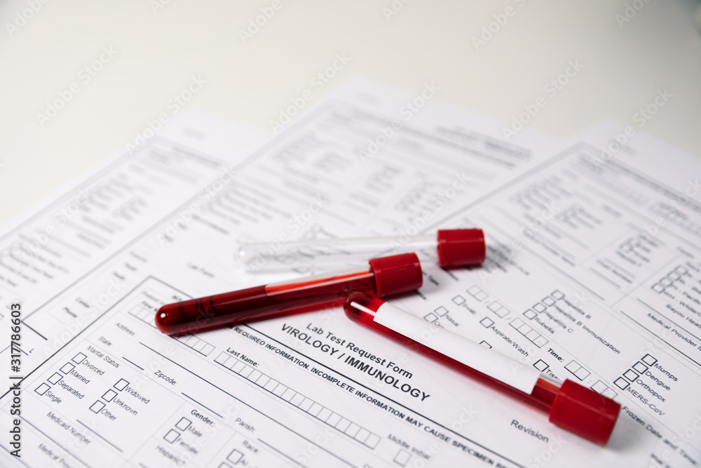 Test tubes with blood. nCov, Coronavirus test Test tubes with blood. nCov, Coronavirus test