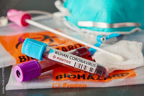 Positive blood test and swab result for the new rapidly spreading Coronavirus, originating in Wuhan, China with a respirator mask and biohazard bags 