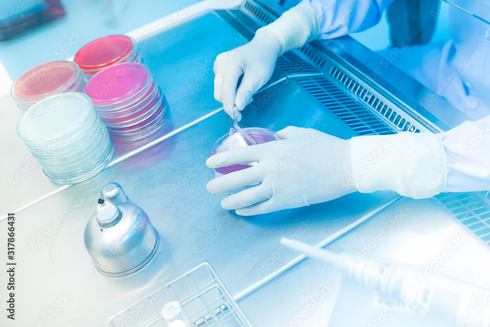 Fototapeta premium Coronavirus 2019-nCoV Coronavirus Outbreak Respiratory virus epidemic in China, many scientists are researching bacteria in jelly plate,research for vaccine production.