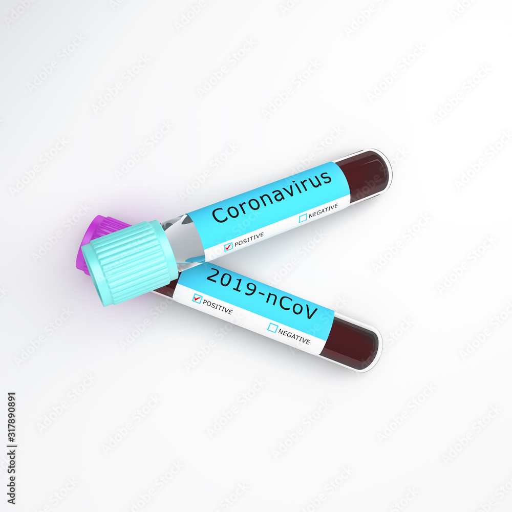 Coronavirus 2019-nCoV blood test tube on studio lighting white background, 3D rendering illustration. Coronavirus 2019-nCoV blood test tube on studio lighting white background, 3D rendering illustration.