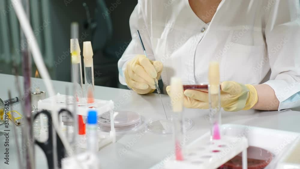 Laboratory specialist doing antibiogram on petri dish with sterile swab, to test sensitivity of isolated bacterial strain. Human reseach concept. 4k video Laboratory specialist doing antibiogram on petri dish with sterile swab, to test sensitivity of isolated bacterial strain. Human reseach concept. 4k video