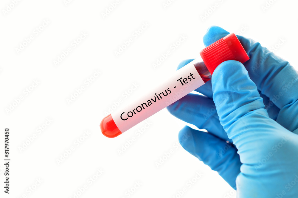 Obraz premium Test tube with blood sample for coronavirus test