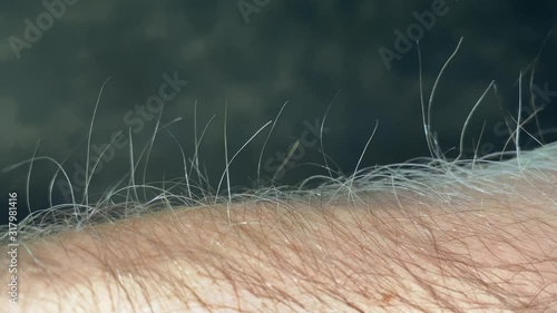 male arm hairs that rise attracted by electrostatic energy photo