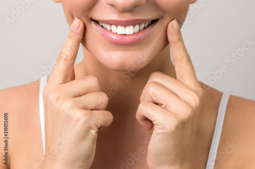 closeup view of female wide cheerful smile with white teeth and clean skin