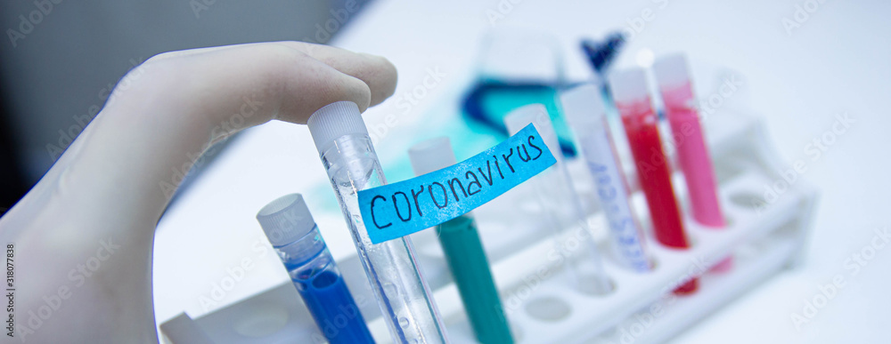 test tube coronavirus, experiments in search of a vaccine. test tube coronavirus, experiments in search of a vaccine.