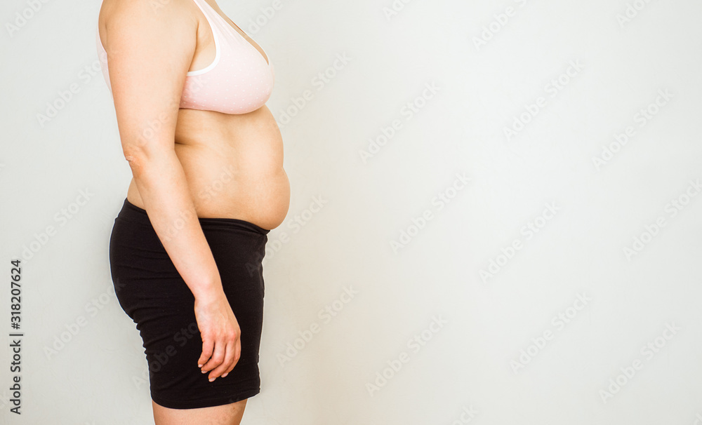 Woman with fat abdomen, overweight female stomach, stretch marks on belly closeup, white background