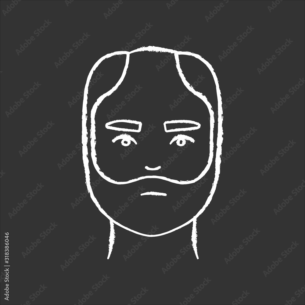 Male hair chalk white icon on black background. Man with alopecia. Hairloss problem. Baldness spot. Dermatology and haircare treatment. Thinning hairline. Isolated vector chalkboard illustration