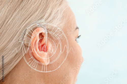 Mature woman with hearing aid on light background, closeup photo