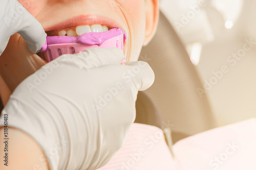 Registration of impressions and bites in a young teenager. Functional modern dental diagnostics.