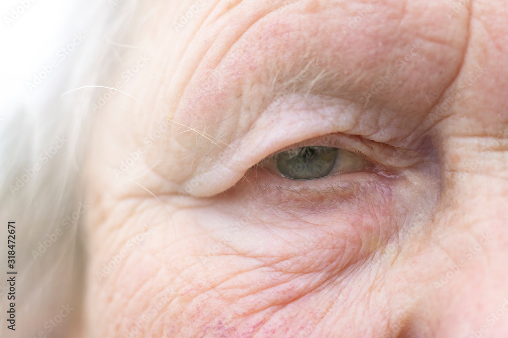 Obraz premium Close-up. Woman aged. Eye in the center of the frame. The pupil has soft focus, the concept of poor eyesight, everything is blurry