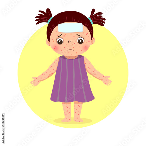 Vector illustration of a little girl with rashes all over her body from measles. Health Problems concept.