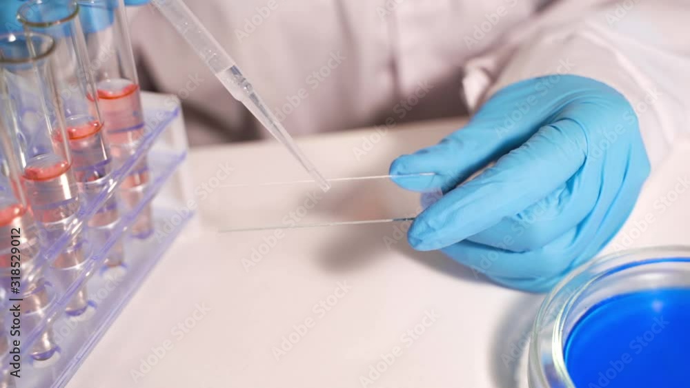 Lab technician conducts test for coronavirus 2019-nCoV. Apply sample to glass for microscopy. Lab technician conducts test for coronavirus 2019-nCoV. Apply sample to glass for microscopy.