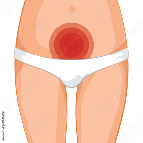 Menstruation. Periodic female pain. Pain in the lower abdomen. Women's thighs with white panties. Simple vector illustration in cartoon style isolated on white background for design and web.