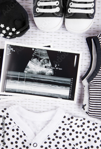 Ultrasound Photo and pregnancy test, gender neutral  photo