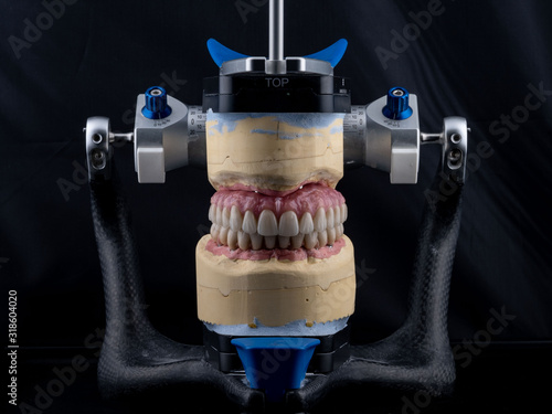 dental implants on a black background