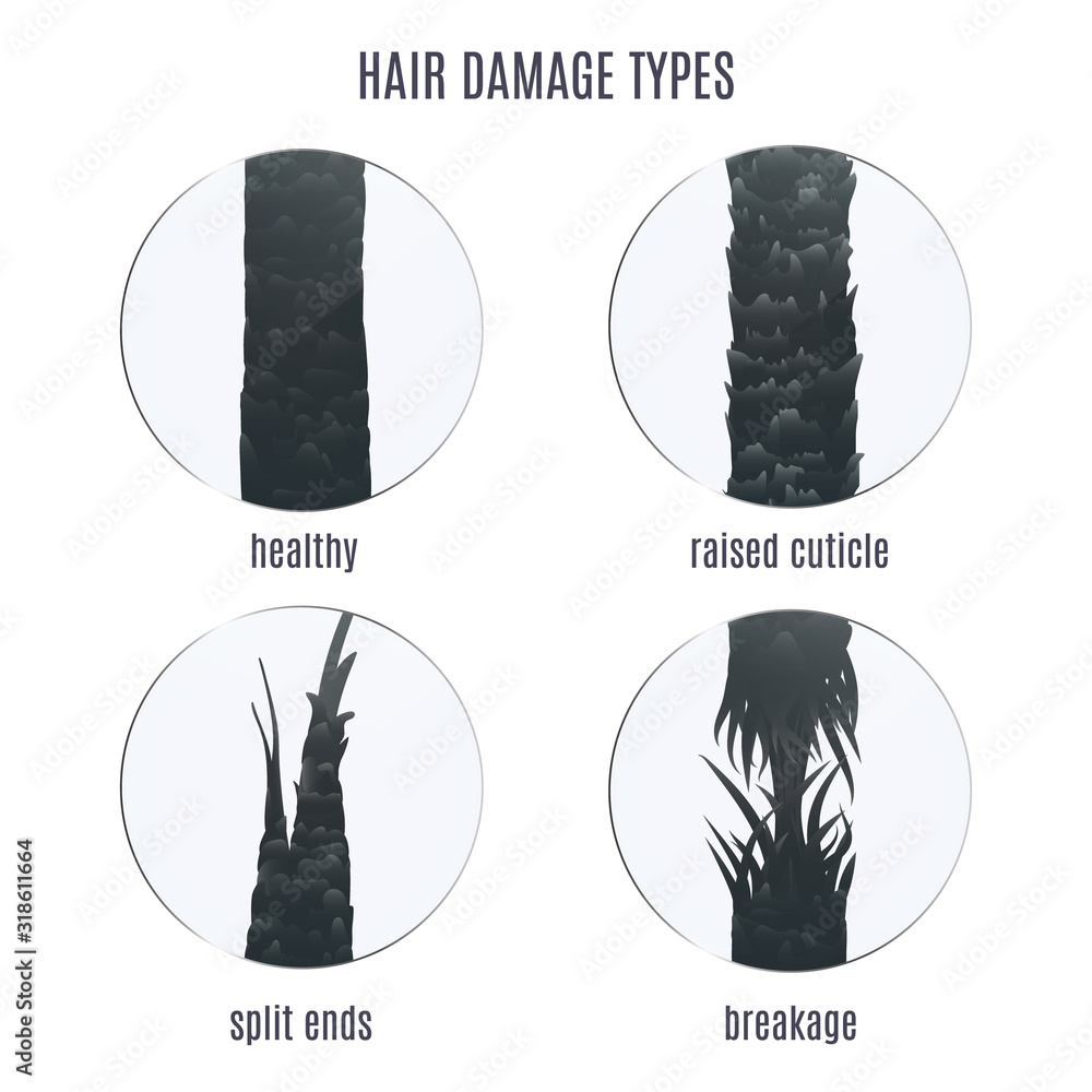 Surface of healthy and damaged hair under the microscope. Hair follicle condition closeup set. Problem of split ends, breakage and raised cuticle. Trichology medical concept. Vector illustration. - obrazy, fototapety, plakaty 