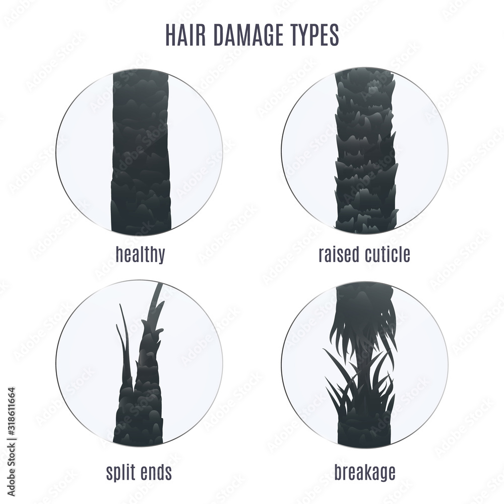 Surface Of Healthy And Damaged Hair Under The Microscope Hair Follicle 