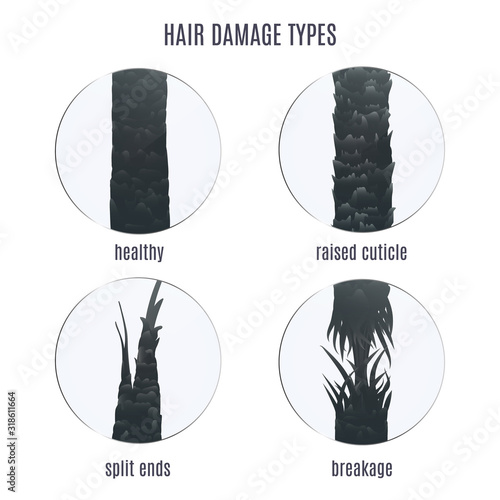 Surface of healthy and damaged hair under the microscope. Hair follicle condition closeup set. Problem of split ends, breakage and raised cuticle. Trichology medical concept. Vector illustration.