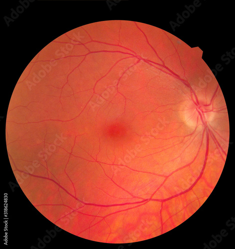 Ophthalmic image detailing the retina and optic nerve inside a healthy human eye. Medicine concept photo
