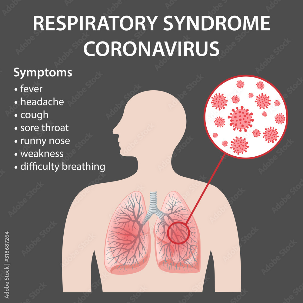 Symptoms of Middle East respiratory syndrome coronavirus in human lungs (MERS-CoV). 2019-nCoV. Concept design. Vector illustration in flat style isolated over black background. Symptoms of Middle East respiratory syndrome coronavirus in human lungs (MERS-CoV). 2019-nCoV. Concept design. Vector illustration in flat style isolated over black background.
