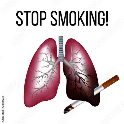 Lungs and smoking, stop smoking. Cancer and tobacco, death and illness, vector illustration