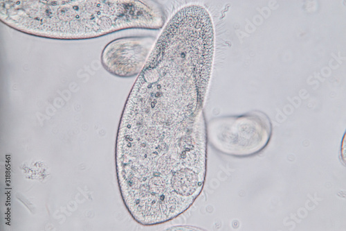 Paramecium caudatum is a genus of unicellular ciliated protozoan and Bacterium under the microscope. photo