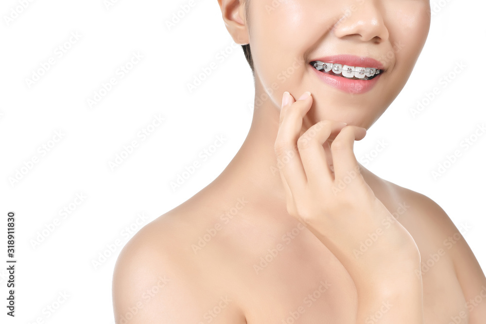 Beautiful women wearing braces in white isolated background. Beautiful women wearing braces in white isolated background.