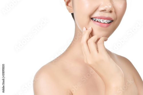 Beautiful women wearing braces in white isolated background.