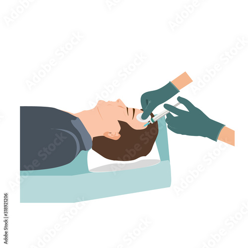 Platelet rich plasma injection procedure for balding men. PRP therapy process. Male hair loss treatment . Vector illustration.