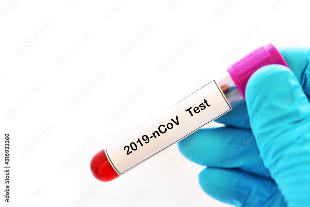 Obraz premium Blood sample tube for coronavirus 2019 test, novel coronavirus found in Wuhan, China