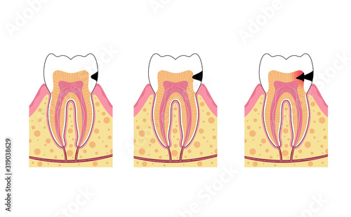 Vector isolated illustration of tooth 