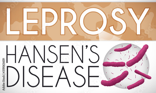 Skin Patches and Enlarged Sample due Hansen's Disease or Leprosy, Vector Illustration