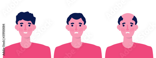 Hair stages loss. Types of baldness on male head vector.