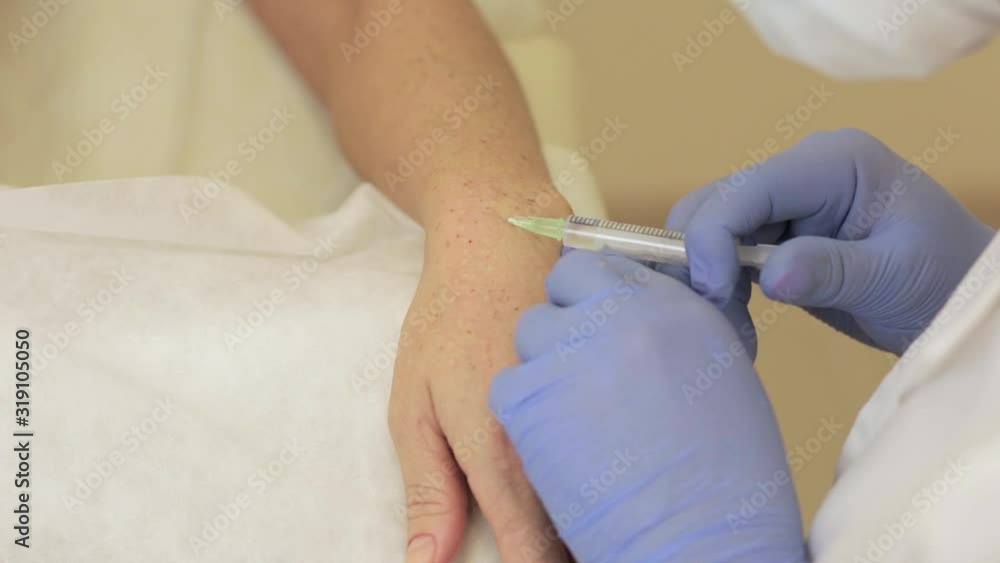 Hand skin biorevitalization is a procedure that aims to improve the quality of the patient’s skin Hand skin biorevitalization is a procedure that aims to improve the quality of the patient’s skin