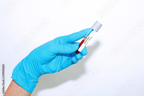  hand holding test tube with blood sample