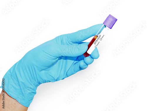 science, chemistry, biology, medicine and people concept - close up of hand holding test tube with blood sample making research in clinical laboratory isolate on white background