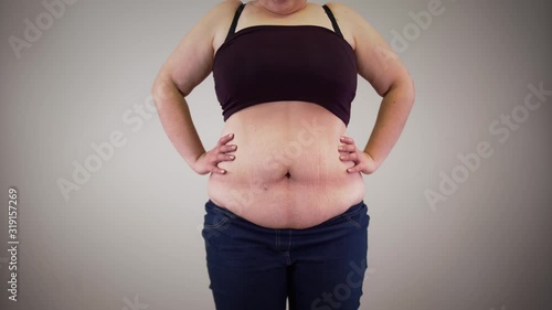 Adult unrecognizable obese woman retracting belly and relaxing. Fat Caucasian woman's body. Obesity, overweight problem.