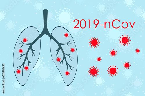 Medical genetics bacteriological Microorganism background. Wuhan Chinese Coronavirus 2019-nCoV. Pneumonia. Bacteria Biology Organisms. Virus infection epidemic sick. Health background. Sick lungs.