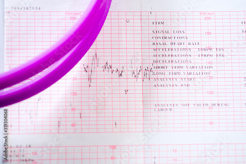 stethoscope on the cardiogram